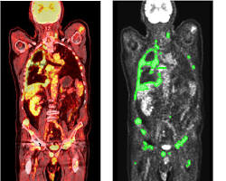 How to Take Care of Stomach