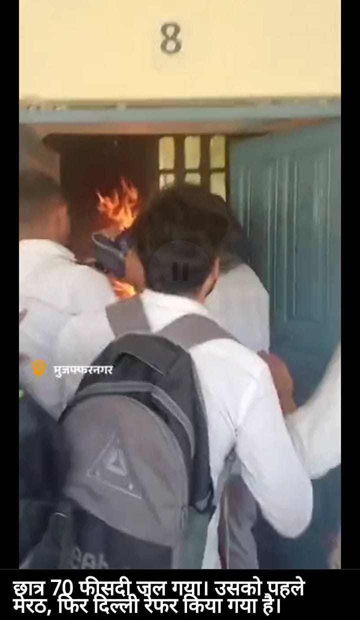 Student sets himself on fire