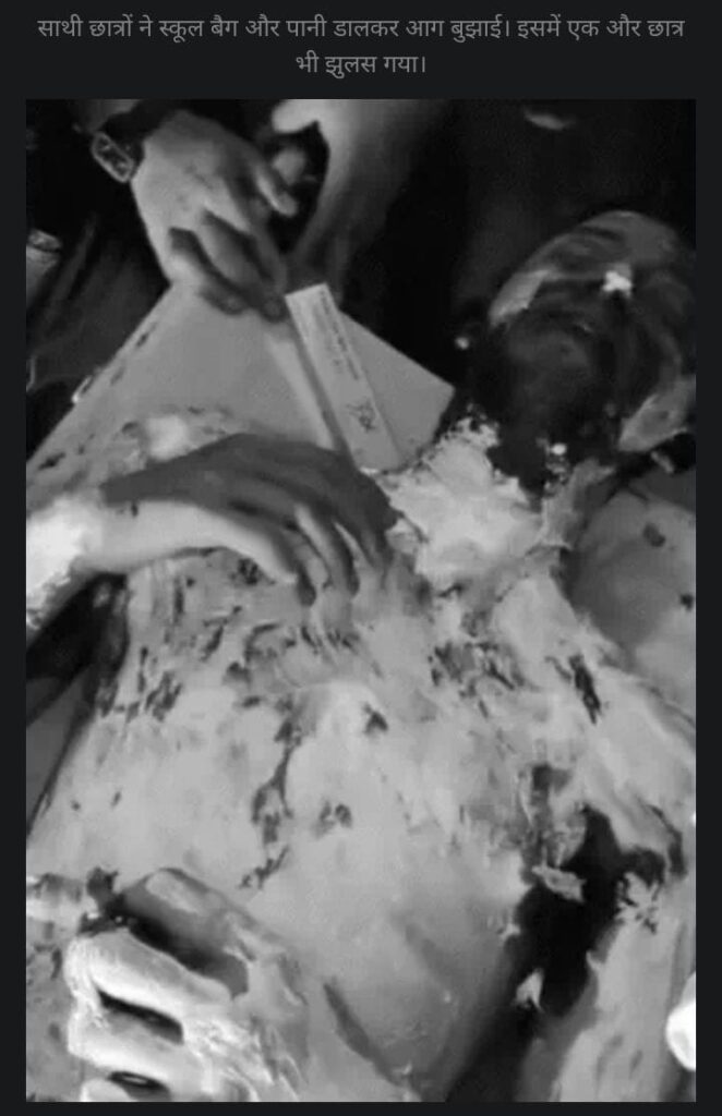 Student sets himself on fire