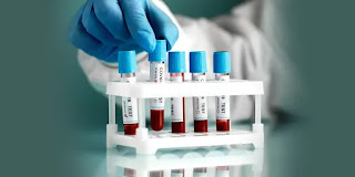 Blood test